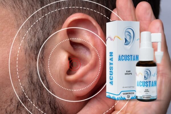 Acustan – What Is It