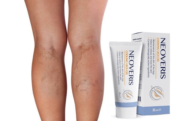 Neoveris cream for varicose veins Reviews - Opinions, price, effects