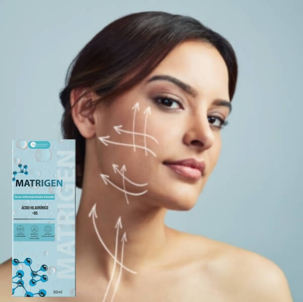 How to Use Matrigen