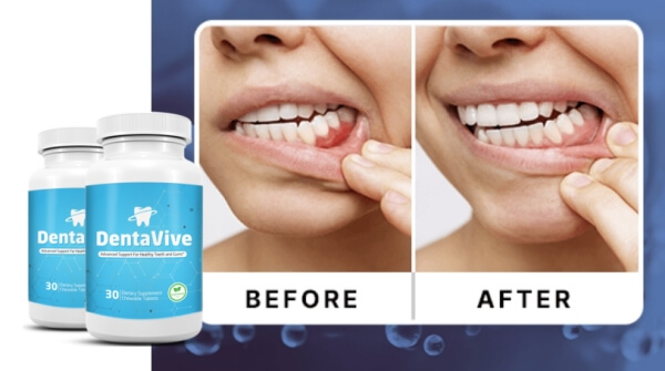 How to Use Dentavive How to Use Dentavive