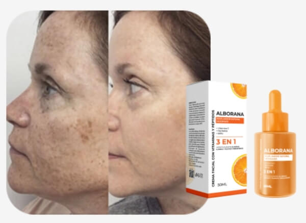 What Is Alborana and What Does It Serve For