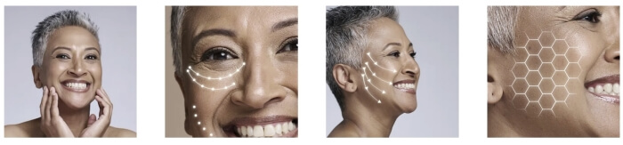 How to Use Lumera – Instructions for Use