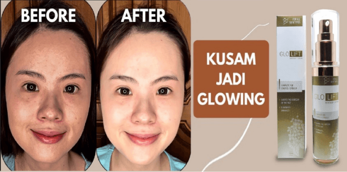 GloLift serum Reviews Indonesia - Opinions, price, effects
